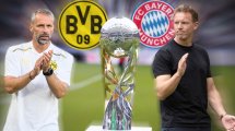 BVB - Bayern: So könnten sie spielen