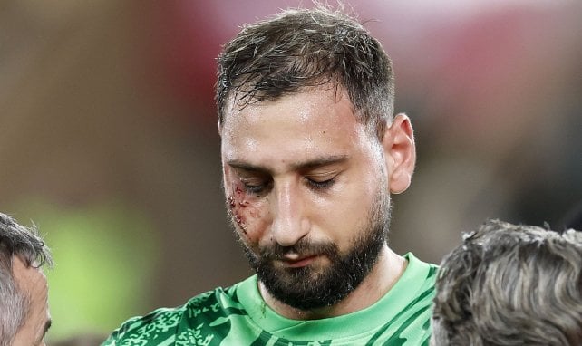 Gianluigi Donnarumma mit Gesichtsverletzung